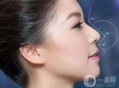 隆鼻后需要注意什么?每個(gè)階段的護(hù)理都不一樣
