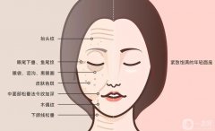 PSV面部提升和五層提拉一樣嗎？