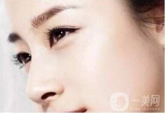 隆鼻后多久恢復(fù)?假體隆鼻的方法有哪些?