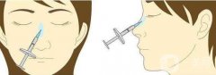 注射隆鼻的價(jià)格是多少?隆鼻有風(fēng)險(xiǎn)嗎?