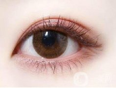 割雙眼皮后拆線要多久?雙眼皮要多久才能恢復(fù)?
