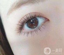 埋線(xiàn)雙眼皮能持續(xù)多少年?埋線(xiàn)雙眼皮多少錢(qián)?