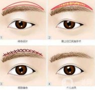 切眉術(shù)和提眉有什么不同?