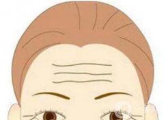 去除抬頭紋的價(jià)錢是多少?什么和因素會(huì)影響價(jià)格?