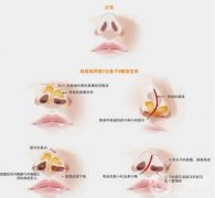 唇裂修復(fù)是什么?唇裂修復(fù)后的疤痕怎么辦?