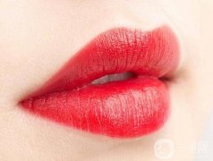非手術(shù)隆唇的方法有哪些呢?