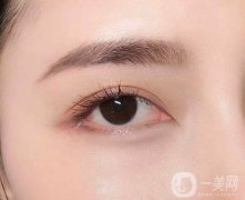 切眉術(shù)留下的疤痕怎么辦?該如何去除疤痕?