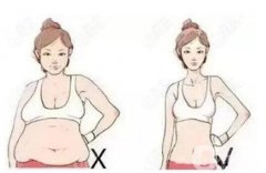 抽脂的成本是多少，抽脂之后如何護(hù)理？