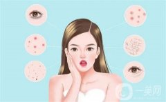 果酸換膚的副作用是什么