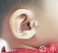 附耳切除有必要嗎?附耳切除術的術前準備包括哪些?