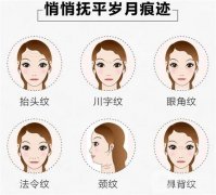 電波拉皮手術(shù)到底好不好？術(shù)后注意事項(xiàng)？