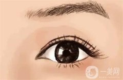 全切雙眼皮要多久才可以自然？多久可以化妝