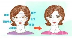 熱瑪吉對法令紋有沒有用？熱瑪吉的應(yīng)用果？