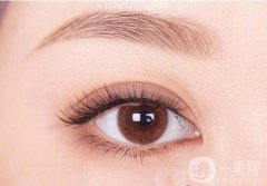 修復(fù)雙眼皮失敗要多少錢?雙眼皮失敗修復(fù)后的注意事項(xiàng)?