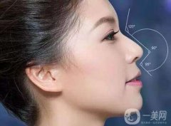 隆鼻的費(fèi)用是多少?隆鼻前需要注意什么?