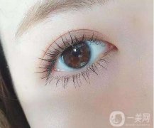 上海九院開(kāi)雙眼皮的價(jià)格是多少?雙眼皮手術(shù)會(huì)留下疤痕嗎?