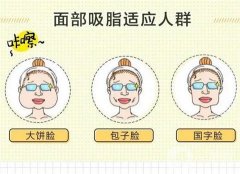 面部吸脂的果是*性的嗎？什么情況下會(huì)反彈？