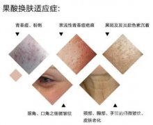 果酸換膚調(diào)節(jié)的間隔時間是多長？需要多久做一次？