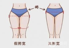 假胯寬可以減掉嗎？具體都有哪些方法呢？