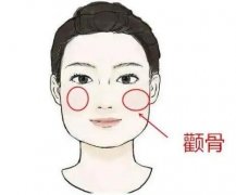 3d顴骨旋轉(zhuǎn)會不會下垂？如何避免失??？