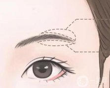 切眉有什么作用和副作用？
