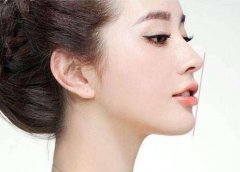 自體軟骨墊下巴好嗎?硅膠假體墊下巴好嗎?