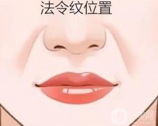 用脂肪填充法令紋能管多久？果如何？