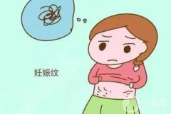 電波拉皮可以去掉妊娠紋嗎？