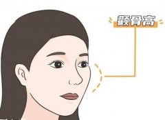 降低顴弓和顴骨內(nèi)推有什么不同？