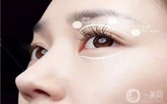 半切開法雙眼皮手術(shù)方法和過程詳解