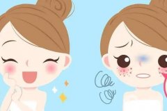 有哪些優(yōu)勢?祛斑結(jié)痂后應(yīng)該怎么護理?