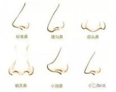 鷹鉤鼻子可以做矯正嗎?