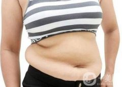 如何減去腹部贅肉?吸脂手術(shù)了解一下!