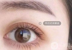 全切雙眼皮7mm寬嗎?果自然嗎?
