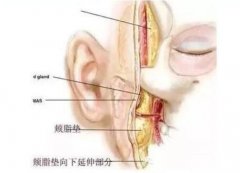 去頰脂墊手術(shù)是怎么做的?價(jià)格是多少?