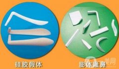 膨體隆鼻后遺癥的出現(xiàn)大概是在什么時(shí)候?