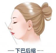 怎樣快速讓下巴變尖變長呢?好方法在這里。