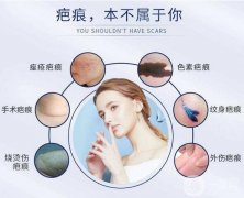 像素激光去除疤痕果怎么樣?
