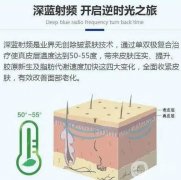 深藍(lán)射頻果能持續(xù)多久？副作用是什么？