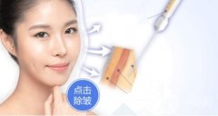 伊維蘭去皺果怎么樣?和玻尿酸除皺有什么區(qū)別?