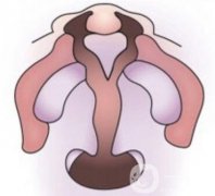 兔唇手術(shù)多少錢?大概價位是多少?
