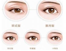 雙眼皮手術(shù)有哪幾種?哪種比較好看?