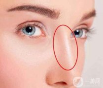 固體硅膠隆鼻有哪些危害?十年了需要更換嗎?