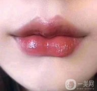 豐嘴唇有沒有*性的?