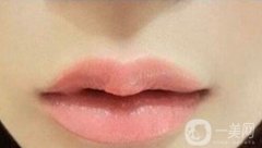 豐唇手術(shù)價格貴不貴?要多少錢?