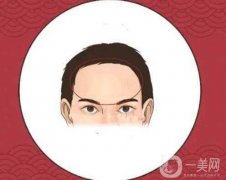 額部填充術(shù)常見方法有哪些?