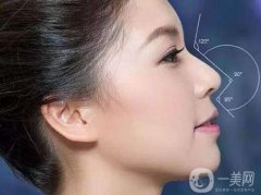 墊高鼻子的風(fēng)險有多大?后遺癥盤點?