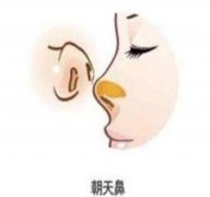 朝天鼻整形價格貴嗎?要多少錢?