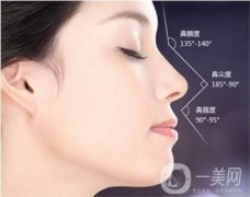 鼻梁矯正紗布取出后還會塌陷嗎?