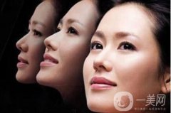 鼻尖美容術(shù)是怎樣做的?